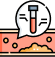 Lipid Profile