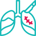 Thoracic Surgery