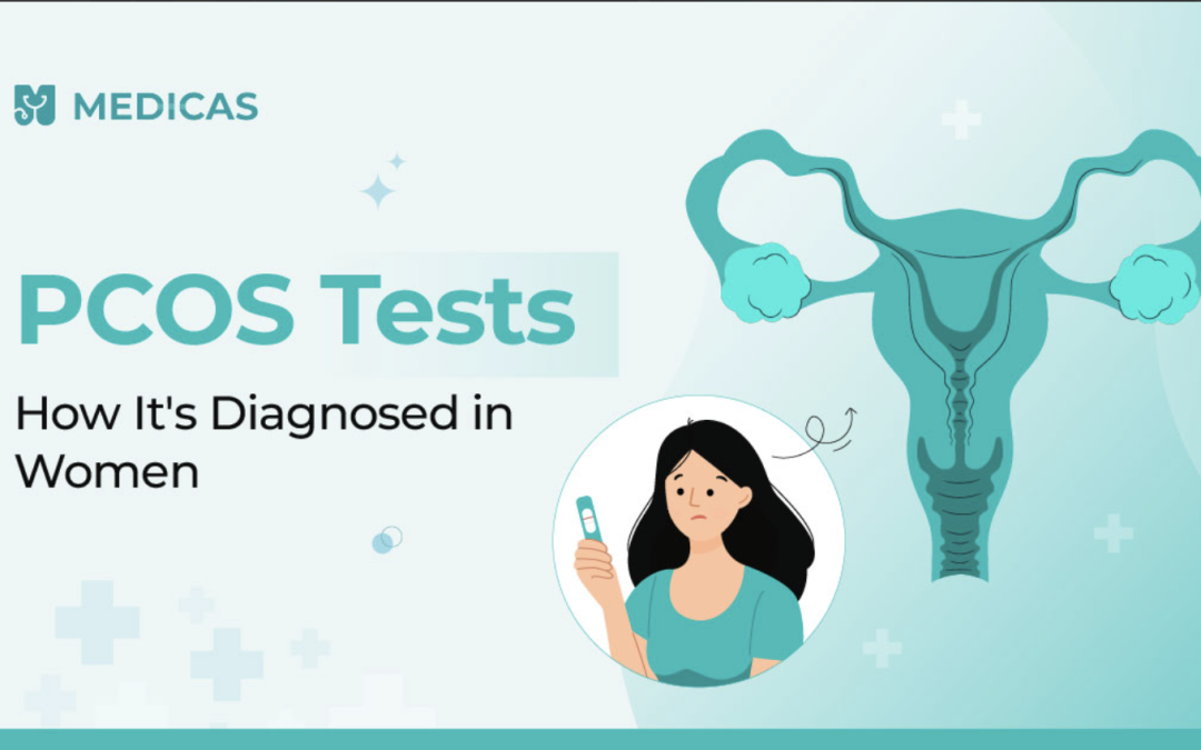 pcos