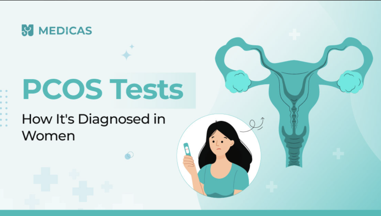 pcos