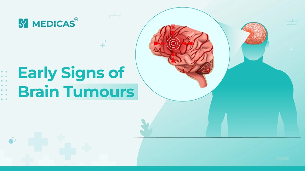 Brain Tumour Warning Signs: Early Indicators You Must Know