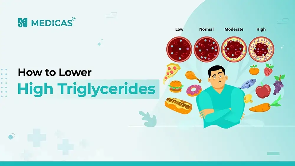 High Triglycerides Treatment: Strategies To Lower Your Levels